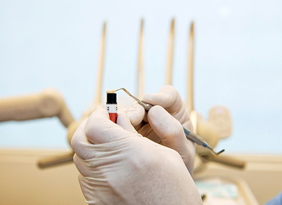 A dentist holding composite resin used for dental bonding