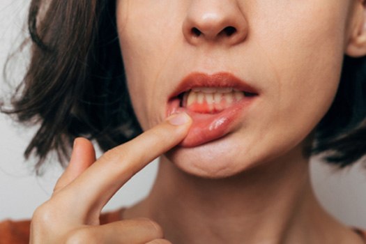 Patient in Black Forest checking gums in mirror